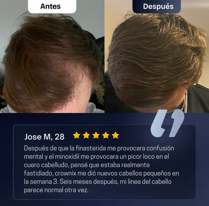 Roll-On de Crecimiento Capilar™